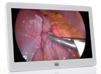 Image: The Barco MDSC-2226 surgical display (Photo courtesy of Barco).